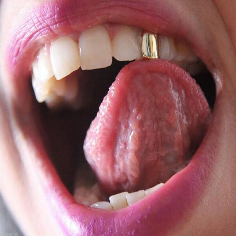 "The-Bullet" Single Tooth
